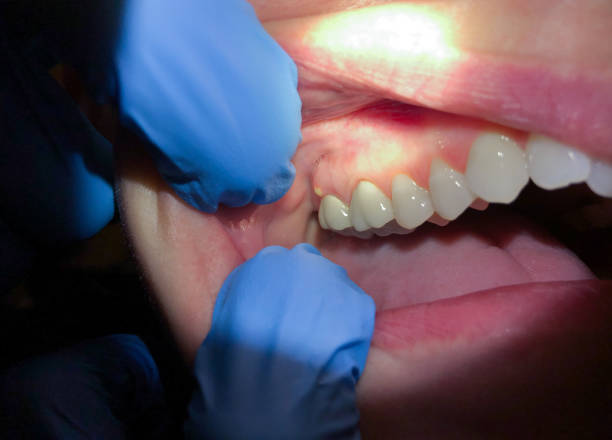 Best Urgent Dental Care for Toothaches in Crenshaw, MS