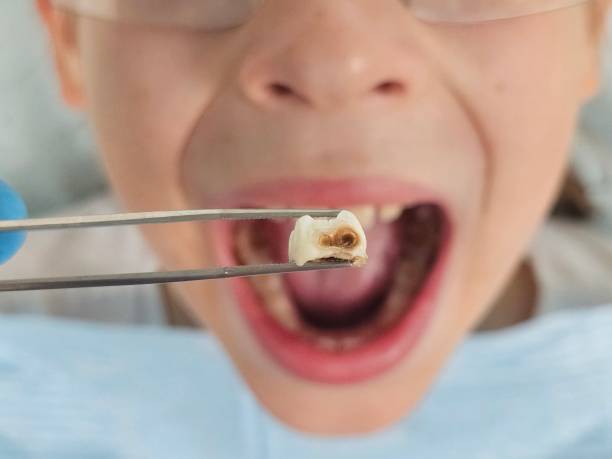  Crenshaw, MS Emergency Dentist Pros